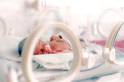 A newborn infant sleeping in NICU with a drip in their nostrils