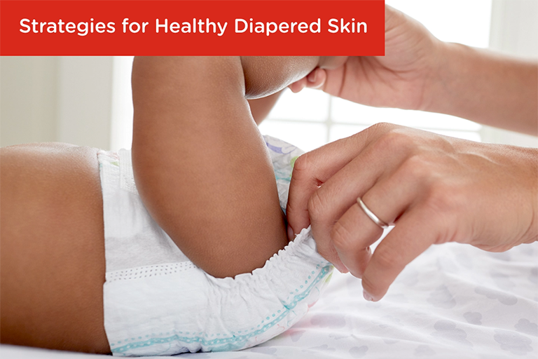 Strategies for Healthy Diapered Skin