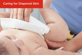 Caring for Diapered Skin