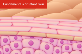 Fundamentals of Infant Skin