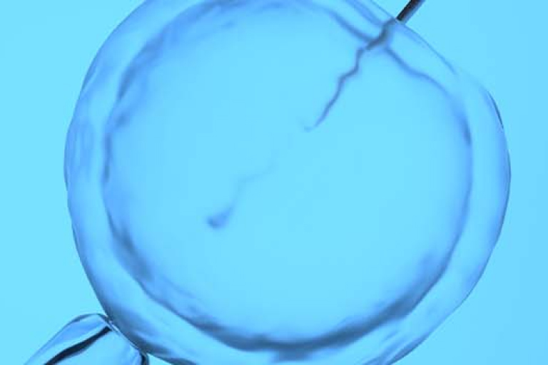 F0157