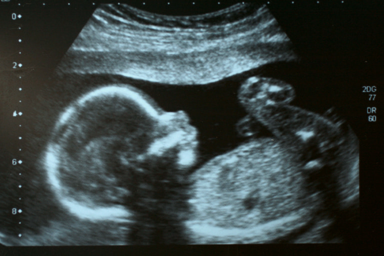 F0272  Babys Development by Trimester